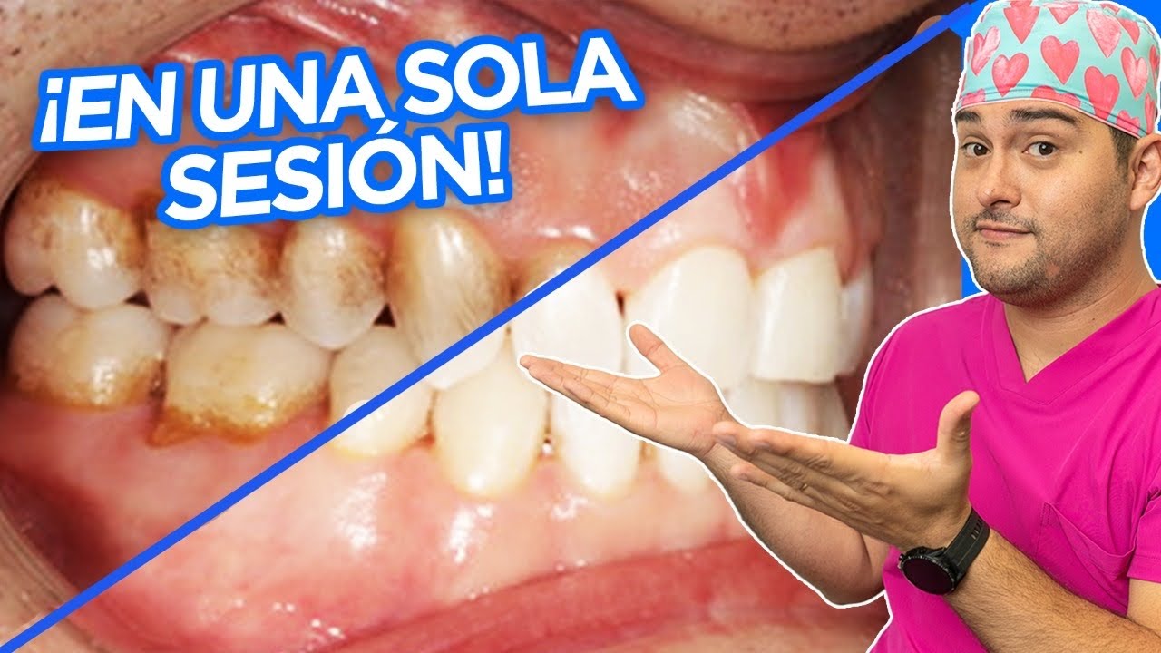el te mancha los dientes