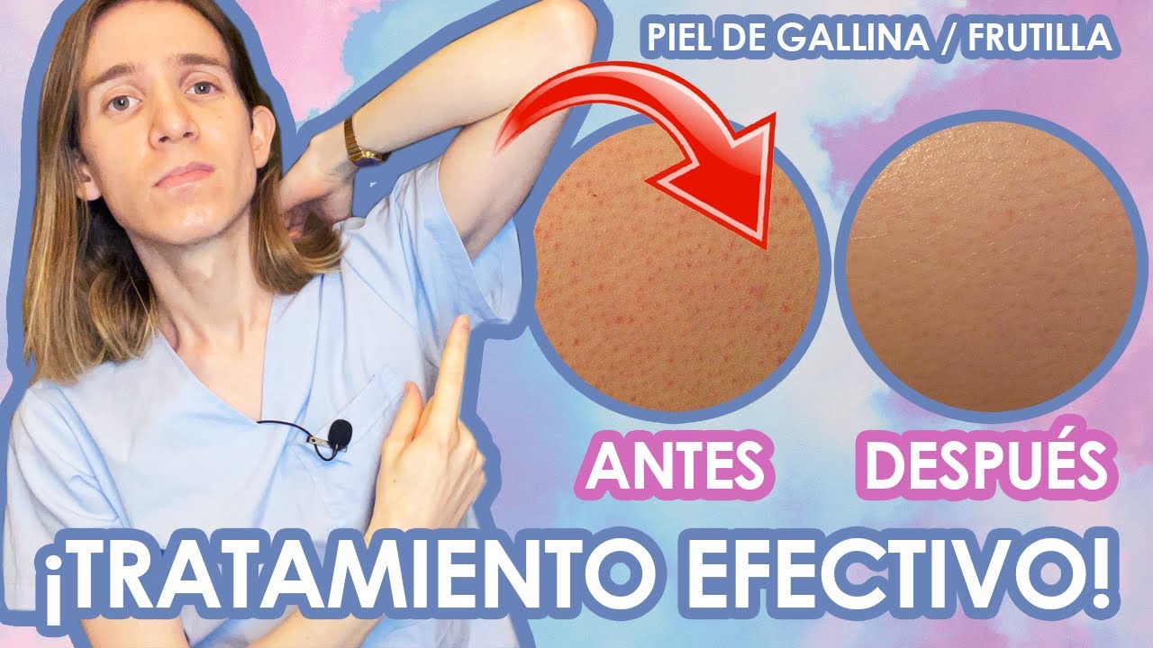 crema para piel de gallina